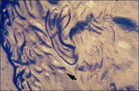 1 2002 P Lincoln cent doubled ear lobe.jpg