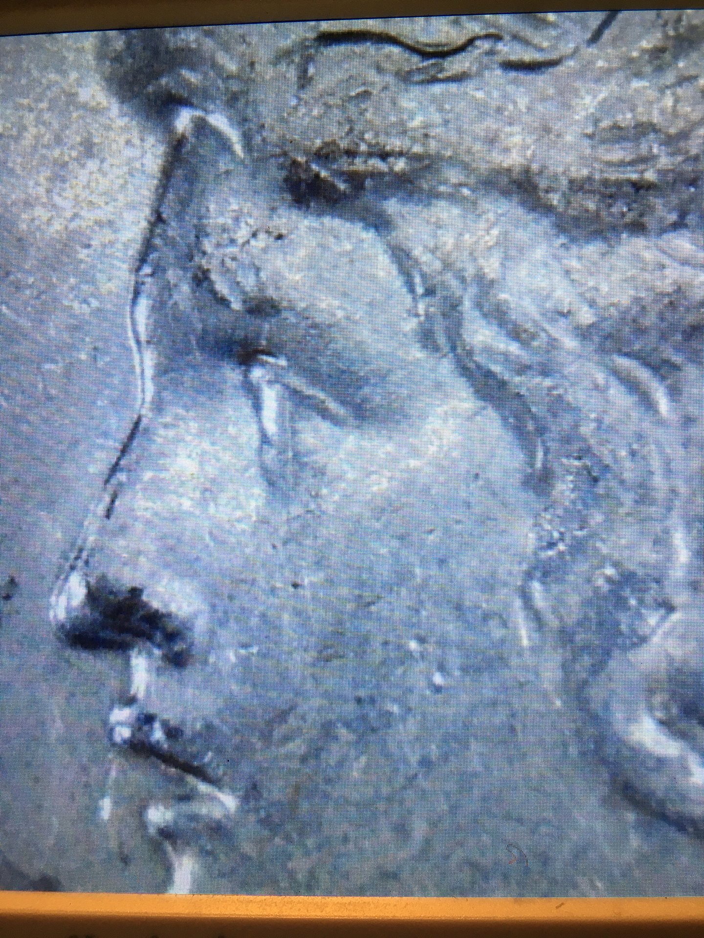 1925 Peace $ dbl nose dbl lip dbl eye.JPG