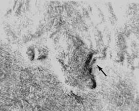1934PDDR001 neck.jpg