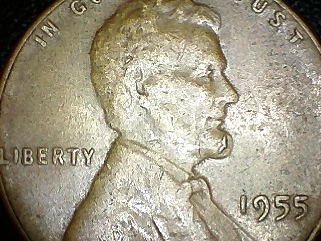 1955 Scar on chin.jpg