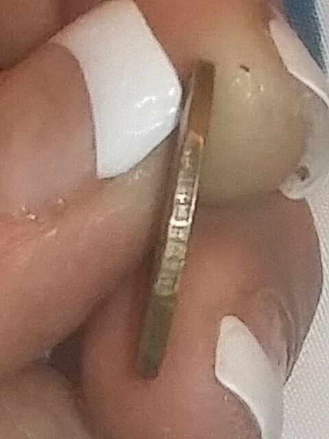 20170714_210209.jpg