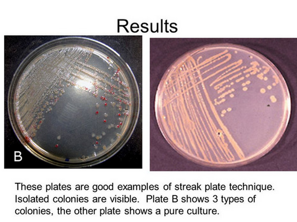 actual-result-of-a-streak-plate-technique.jpg