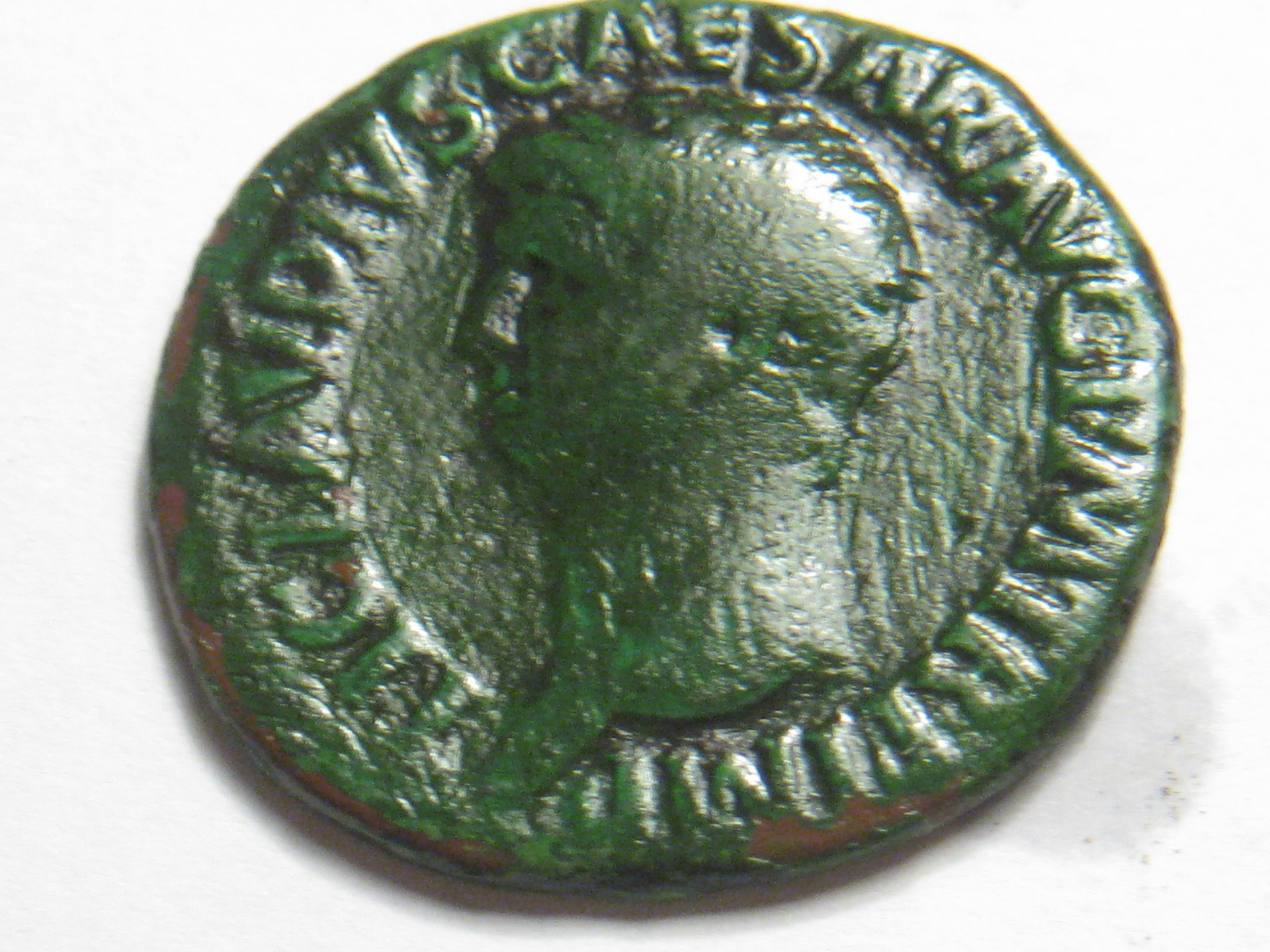 claudius AE AS b4 and after verdi care app 003.JPG
