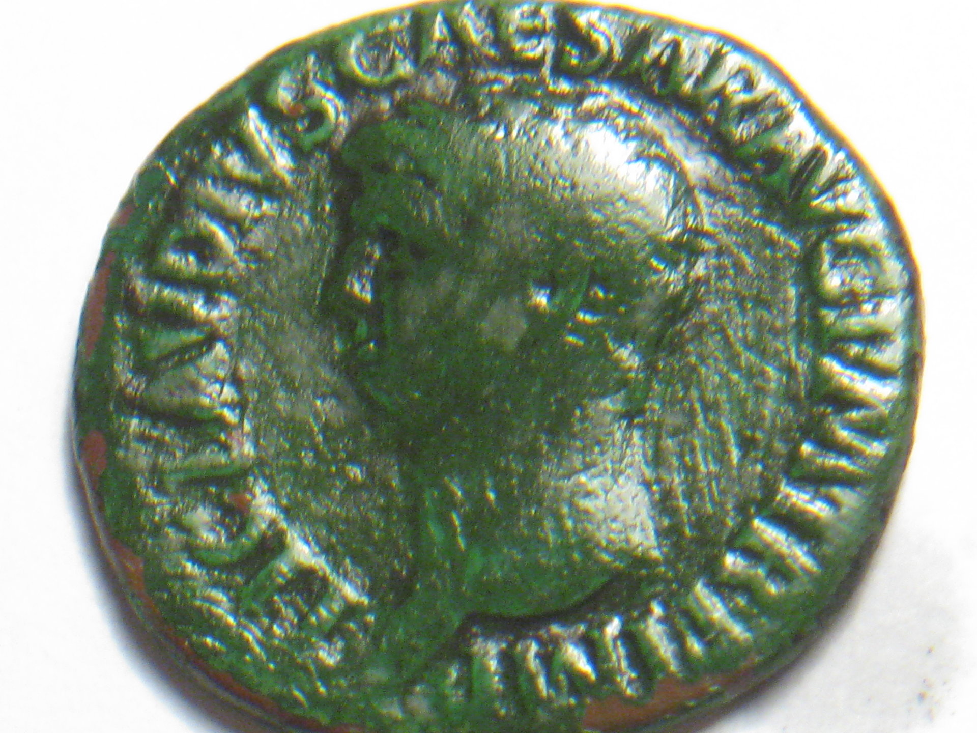 claudius AE AS b4 and after verdi care app 004.JPG