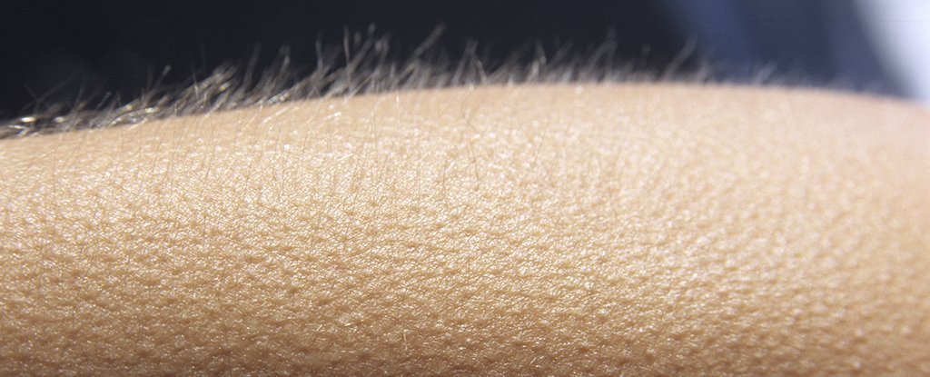 goosebump-arm-1_1024.jpg