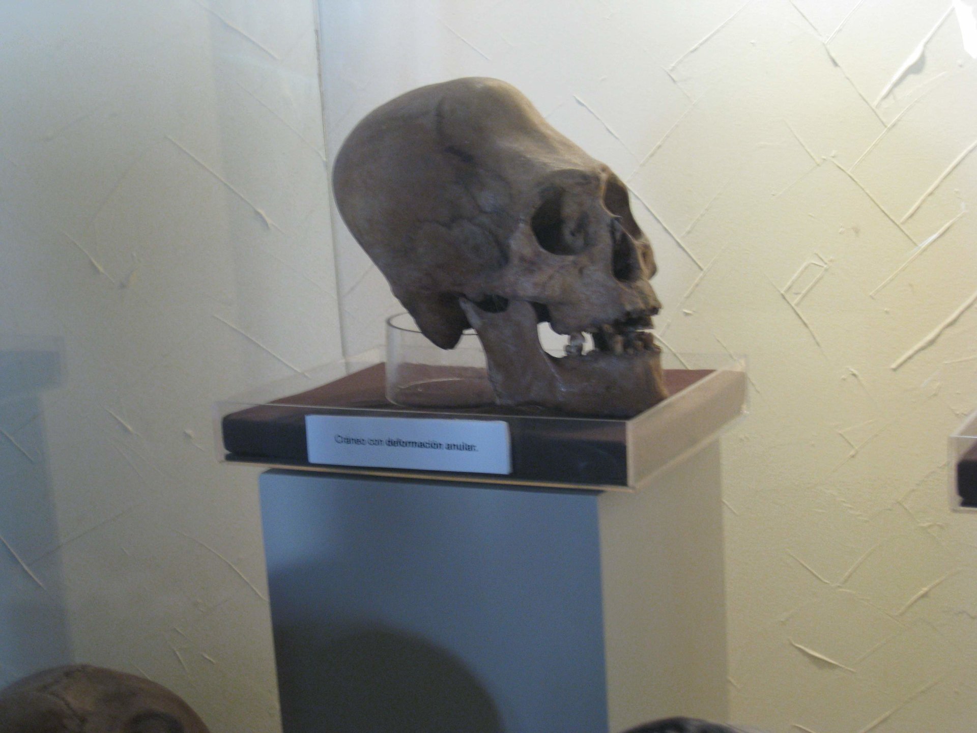 Peru skull.jpg