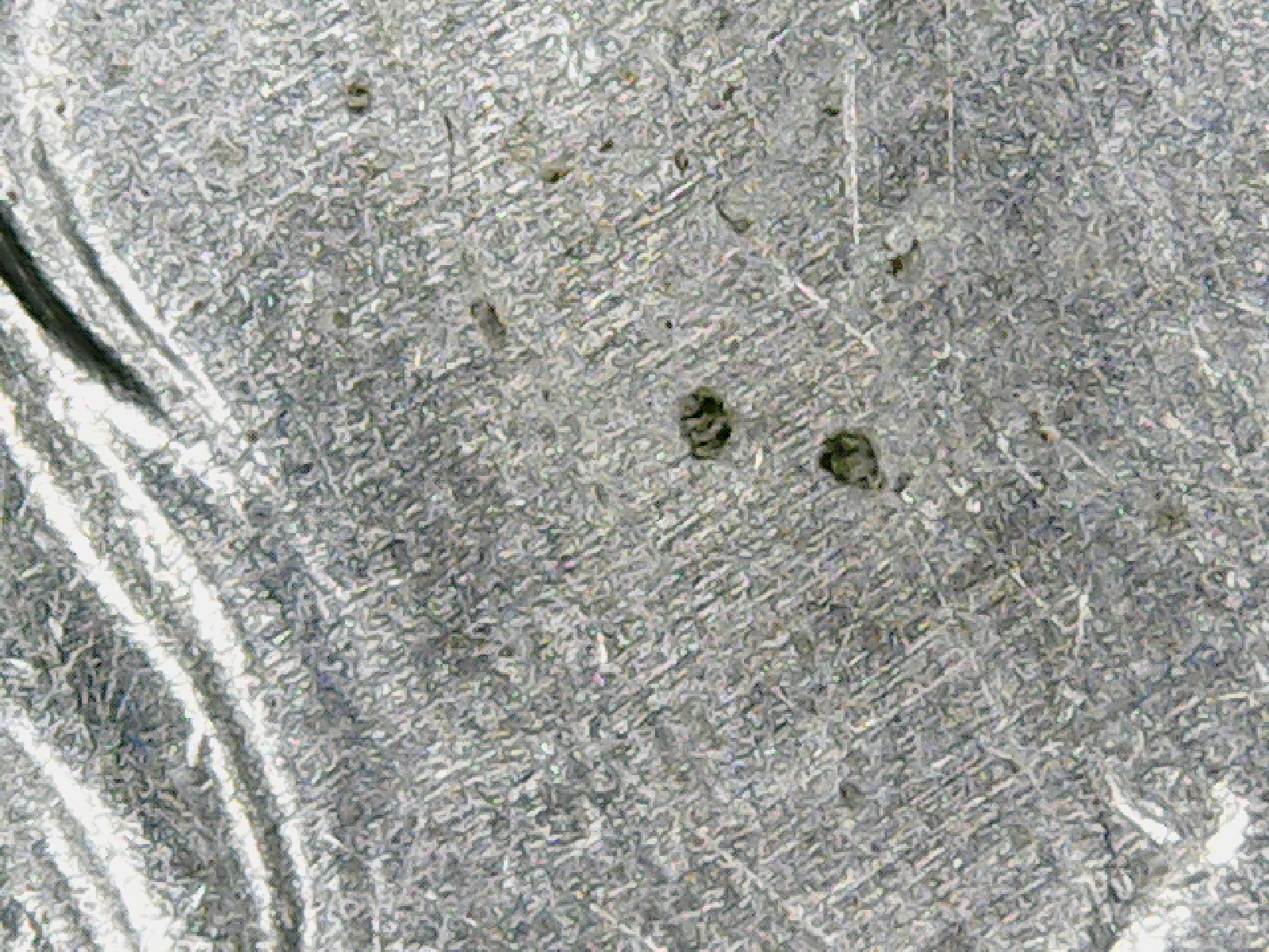 pitting field behind head.jpg