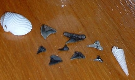 teeth.jpg