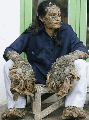 treeman.gif
