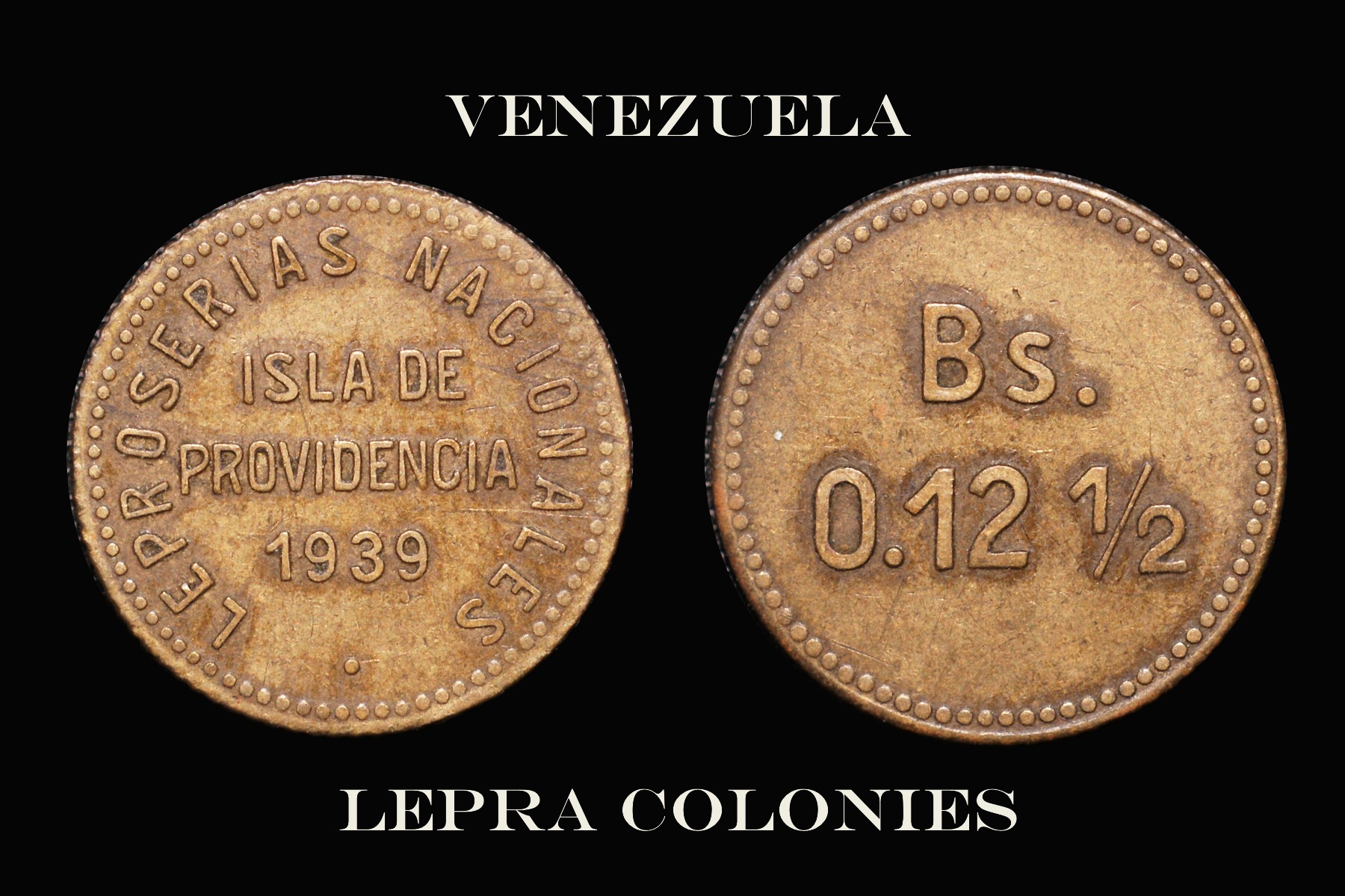 Venezuela lepra.jpg