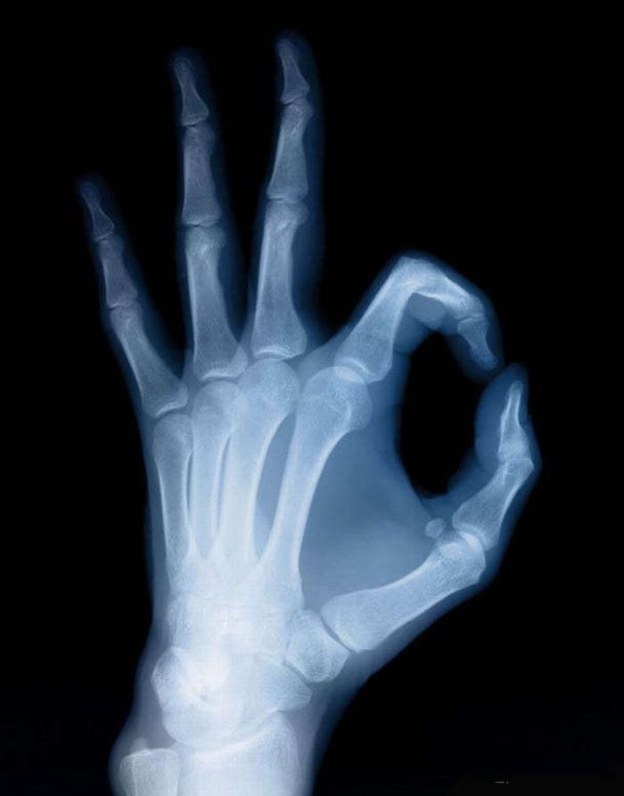x-ray-31.jpg