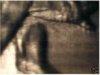 2005DetachedLegBuffLG.jpg