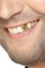 Gold-Tooth-Cap.jpg