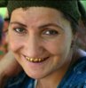 woman-copper-teeth.jpg