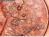 1982 penny messy obv 3.jpg