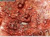 1982 penny messy obv 5.jpg