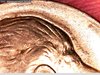 1984 P Dime halo 7.jpg