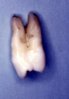 human%20tooth.jpg
