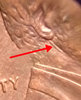 1993-slit-neck.jpg