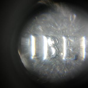 Upper B